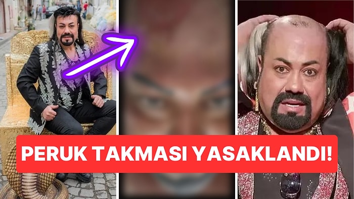 Protez Saç Yüzünden Başına Gelmeyen Kalmadı: Kobra Murat Enfeksiyon Nedeniyle Konserlerini Erteledi!