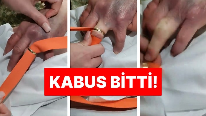 Her Güne Yeni Bi’ Bilgi: Parmağınıza Sıkışan Yüzüğü Çıkarmak Artık Çile Çektirmeyecek