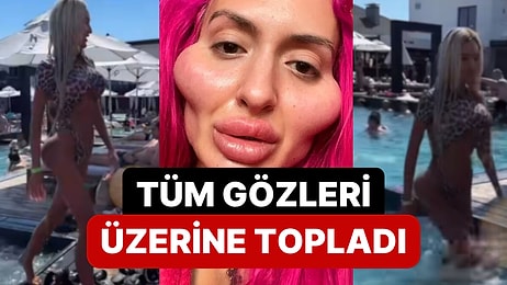 Dünyanın En Büyük Elmacık Kemiğine Sahip Anastasia Pokreshchuk Baştan Aşağı Estetikli Vücuduyla Dikkat Çekti