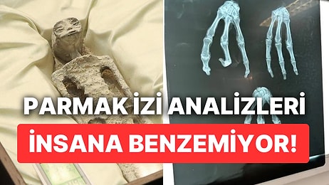 Uzaylı Mumyaların Parmak İzi Analizi Çıktı: 'İnsan Kökenli Olmadıkları' İddia Edildi