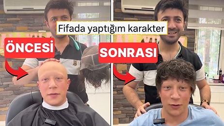 Saç Protezi Videosu Sosyal Medyada Gündem Yarattı: Müşteri Memnun, İzleyici Şaşkın!