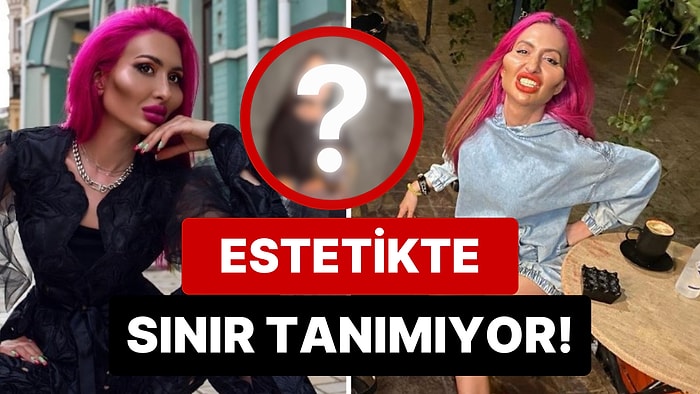 Dünyanın En Büyük Elmacık Kemiklerine Sahip Anastasia Pokreshchuk’un Son Hali "Bu Kadar da Olmaz" Dedirtti