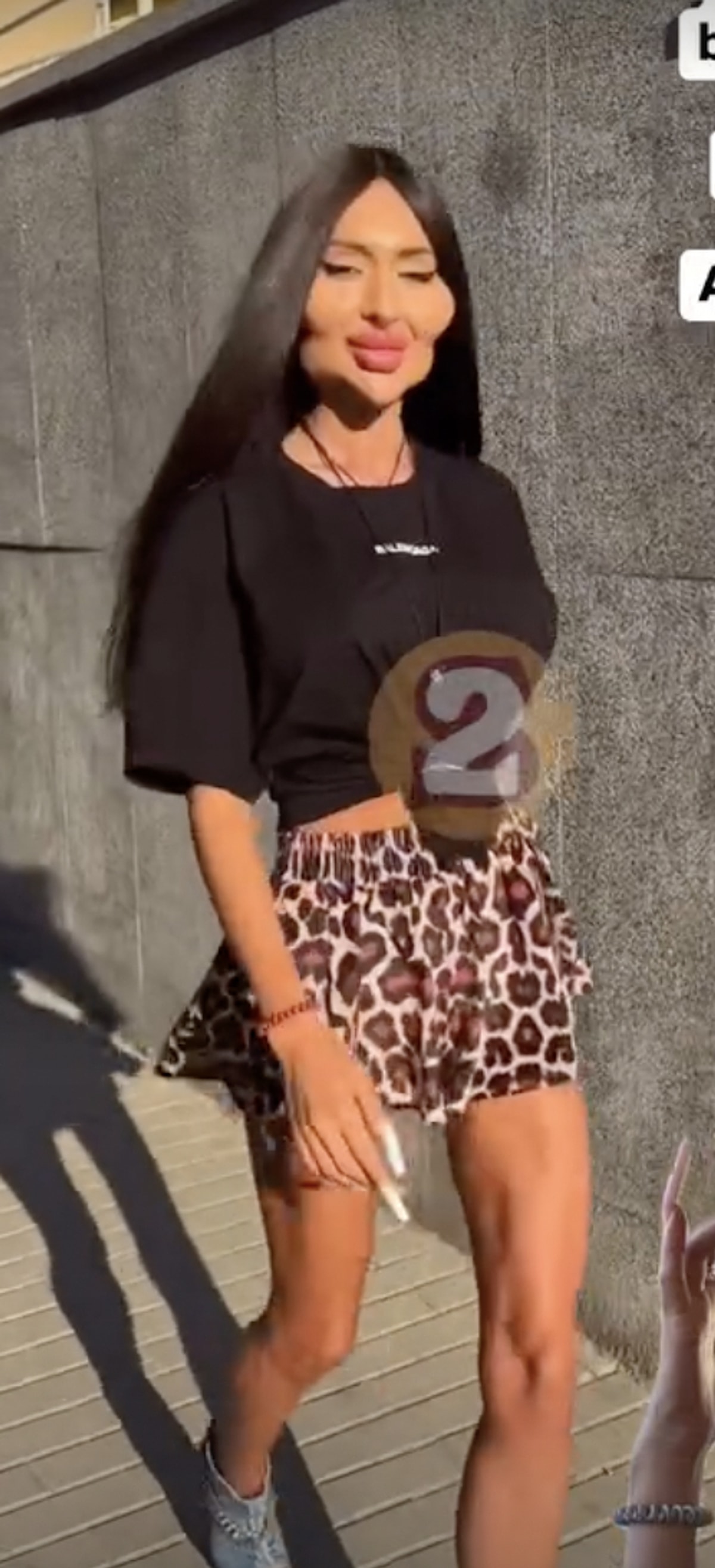 Dünyanın En Büyük Elmacık Kemiklerine Sahip Anastasia Pokreshchuk’un