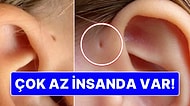 Çok Az İnsanda Var: Neden Bazılarımızın Kulağının Yanında Boşluk Var?