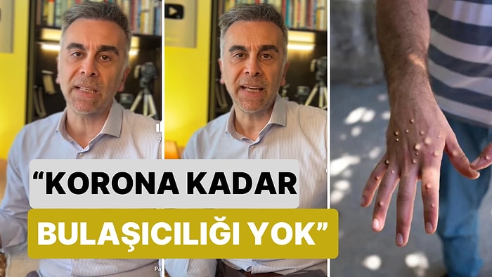 Doktor Murat Aksoy DSÖ'nün Acil Durum İlan Ettiği Maymun Çiçeği Hastalığı ile İlgili Bilgi Verdi