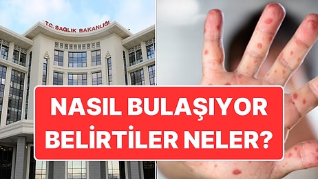 Sağlık Bakanlığı’ndan Maymun Çiçeği Rehberi: Virüs Nasıl Bulaşıyor, Belirtileri Neler?