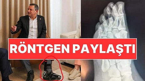 'Ayağından Vuruldu' İddiaları Sonrası Özgür Özel'den Röntgen Filmi Paylaşımı!