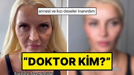 Tüm Yüzüne Yaptırdığı Estetik İşlemlerle En Az 20 Yaş Gençleşen Kadın “Doktor Kim” Dedirtti