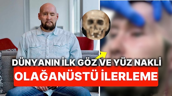 Tıpta Umut Verici Gelişme! Dünyada İlk Tam Göz Nakli Yapılan Hastanın Gözü Artık Işığa Tepki Veriyor!