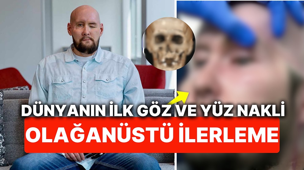 Tıpta Umut Verici Gelişme! Dünyada İlk Tam Göz Nakli Yapılan Hastanın Gözü Artık Işığa Tepki Veriyor!