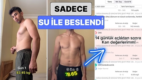 14 Gün Boyunca Sadece Su ile Beslenen Genç 14 Günün Sonunda Yaşadığı Değişimi Paylaştı