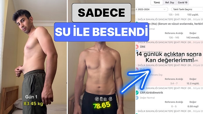 14 Gün Boyunca Sadece Su ile Beslenen Genç 14 Günün Sonunda Yaşadığı Değişimi Paylaştı