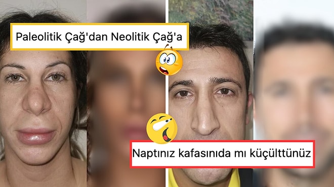 Estetik Müdahalelerle Görünümünü Tamamen Değiştirerek Adeta Çağ Atlayan 15 Kişi