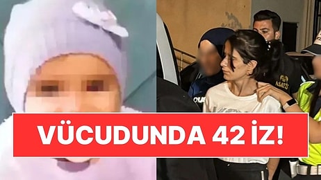 Tekirdağ'da İstismara Uğrayan 2 Yaşındaki Sıla Bebekle İlgili Korkunç Detaylar: Vücudunda Diş İzleri!