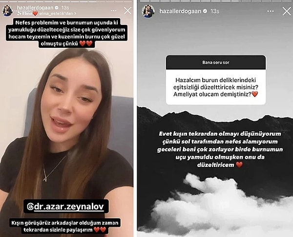 Hazal'ın tam da Dilan Polat'ın "intihar ettiği" iddiası gündemdeyken estetik üzerine gülerek paylaşım yapmasını affetmeyen olaylı fenomenin duruma çok kızdığı da söylenmişti.