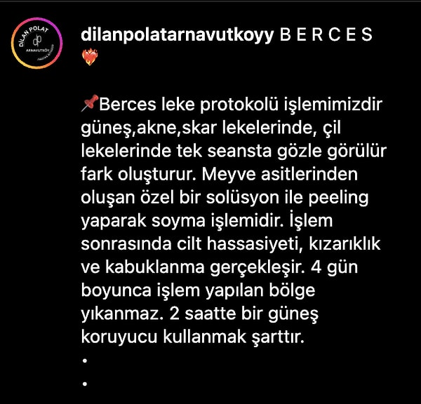 "Berces işlemi nedir?" diye merak edenlere Dilan Polat'ın şubelerinden birinin Instagram açıklaması da şu şekilde 👇