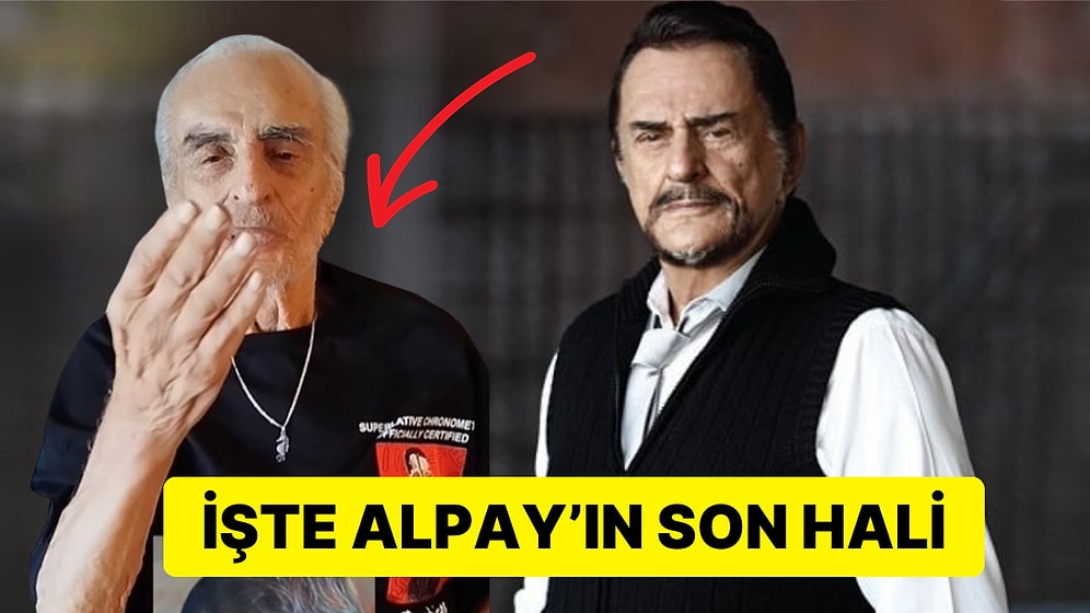 Bir Döneme Damga Vuran Efsane Şarkıcı Alpay'ın Son Hali Sevenlerini Üzdü