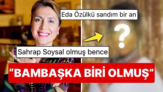 Hudutsuz Sevda İçin Poz Veren Asuman Dabak Yüzündeki Değişimle Sahrap Soysal'a Benzetildi!