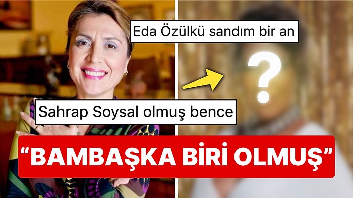 Hudutsuz Sevda İçin Poz Veren Asuman Dabak Yüzündeki Değişimle Sahrap Soysal'a Benzetildi!