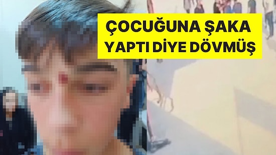 Çocuğuna Şaka Yaptı Diye 13 Yaşındaki Çocuğu Tokatladı