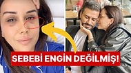 Ablasına Taşınıp Evde Bile Gözlük Takan Dilan Polat'ın Yüzündeki Morlukların Nedeni Nihayet Belli Oldu!