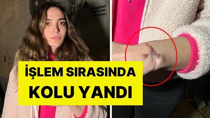 Güzellik Merkezinde Feci Olay! Sildirmek İstediği Dövme Başına Dert Oldu: “Kolumu Yaktılar”