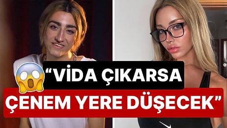 Yüzünde Dört Vida Var: Cinsiyet Geçiş Sürecini Tamamlayan Mika Raun Ameliyatının Detaylarını İlk Kez Anlattı!