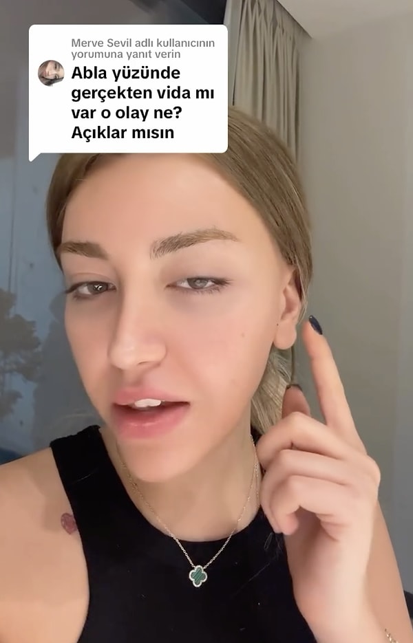 Ayrıca birkaç gün önce yüzünün sol üst tarafındaki vidanın yerinden oynadığını vurgulayan Raun, "Eğer o video yerinden çıkarsa çenem yere düşecek. Zaten doğru düzgün yemek yiyemiyorum, çigneyemiyorum, çok acıyor. Kontrole gideceğim, vidamın sıkılması gerekiyorsa sıkacaktır doktor ama işte burayı açacak kapatacak falan çok uzun iş" açıklamasında bulundu.