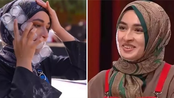 Kızgın Yağ Dökülmüştü: MasterChef Beyza, Yüzündeki Yaranın Son Durumunu Açıkladı