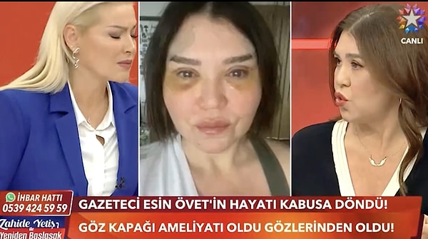 "Hastaneden çıkmadan ayağa kaldırırdım derdim bu olsaydı. Sadece geçirmeye çalıştım, o dönemde 'Alerji kaptım', 'Gözümü iyileştirmeye çalışıyorum' diye saçma sapan yalanlar uydurarak 8 ay geçirdim."