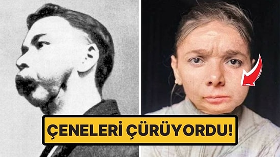 Bir Zamanlar İngiltere'de Kimyasallarla Çalışmaya Mecbur Bırakılan İşçilerin Korkunç Hikayesi