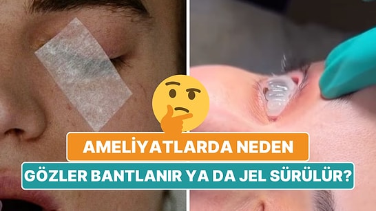 Ameliyatlarda Hastaların Gözleri Neden Bantlanır ya da Jel Sürülür? Meğer Sebebi Çok Kritikmiş!