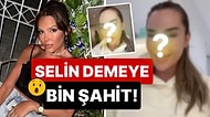 Yüzüne Ne Olmuş? Kaş Modelini Bir Türlü Seçemeyen Selin Ciğerci'ni Son Hali Görenleri Şoka Soktu!
