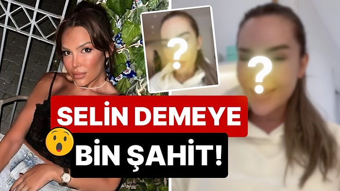 Yüzüne Ne Olmuş? Kaş Modelini Bir Türlü Seçemeyen Selin Ciğerci'ni Son Hali Görenleri Şoka Soktu!