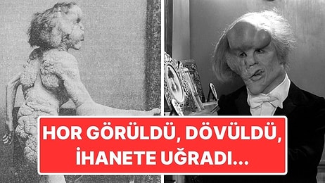 Fil Adam Olarak da Bilinen Joseph Merrick'in Dram Filmlerine Konu Olabilecek Kadar Trajik Hayatı