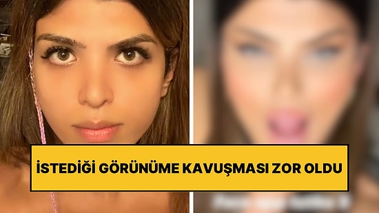 Photoshop Uygulamasındaki Efekti Beğenen Kadın Ameliyatlarla Kendini O Hale Dönüştürdü