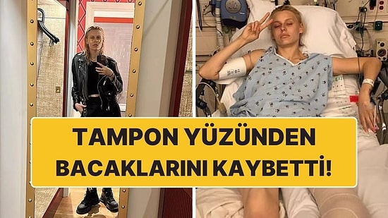 Kullandığı Tampon Yüzünden İki Bacağını Kaybeden Kadın Tamponun Tehlikelerini Göz Önüne Serdi