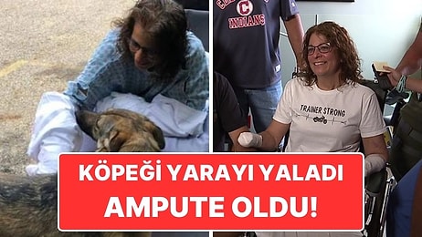 Kolundaki Yarayı Köpeğine Yalattıktan Sonra Kolları Ampute Edilen Kadın