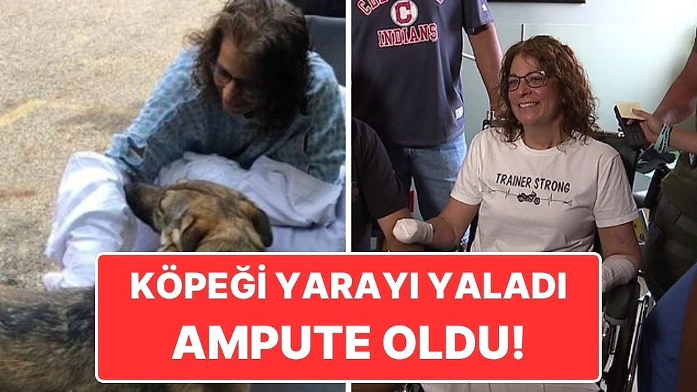 Kolundaki Yarayı Köpeğine Yalattıktan Sonra Kolları Ampute Edilen Kadın