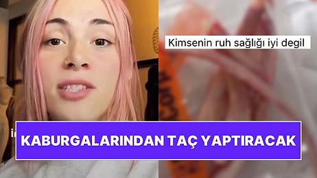 Daha İnce Bir Bel İçin Kaburgalarını Aldıran Kadın Bir de Kemiklerden Taç Yaptırmaya Karar Verdi!