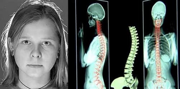 Ancak bilim insanları, X-ray görüşünün gerçek olup olmadığı konusunda hala kesin bir kanıt sunabilmiş değil. Gerçek mi, yoksa iyi bir gözlem yeteneği mi? Yanıtı hala belirsiz...