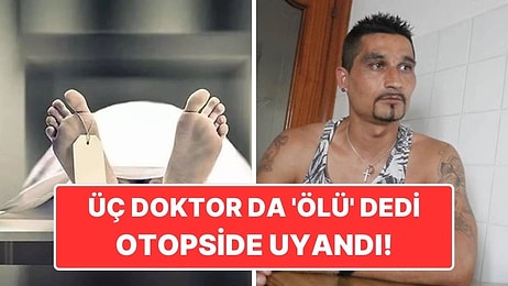 Üç Doktorun da 'Ölü' Dediği Mahkumun Otopsi Öncesi Uyanmasının Ardındaki Şaşırtıcı Olay