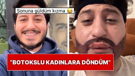 Sakal Ekimi Yaptıran Adam Operasyondan Çıktıktan Sonraki Halini Paylaşmasıyla Viral Oldu