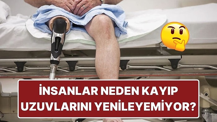 Bazı Hayvanlar Kayıp Uzuvlarını Yenileyebilirken İnsanlar Neden Yenileyemiyor?