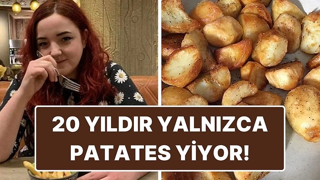 Hastalığı Yüzünden 20 Yıldır Yalnızca Patates Yiyebilen Kadın: Jodie Shaw