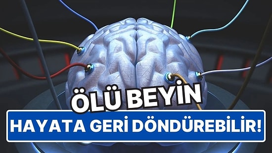 Yine de Bir Sorun Var: Bilim İnsanları, Ölü Bir Beyni Hayata Döndürebileceklerini Kanıtladı!