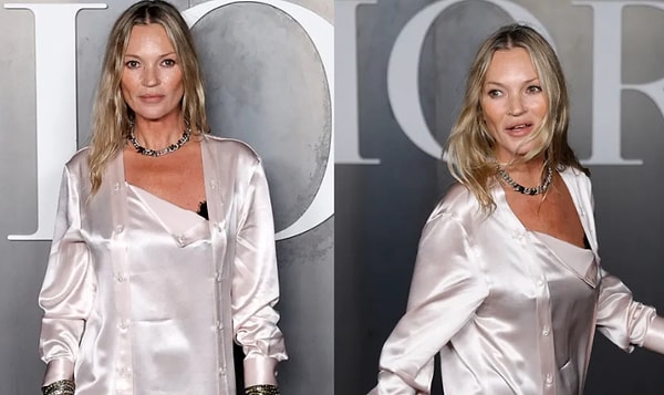 Geçmişteki kötü alışkanlıkların ve yaşam tarzının kurbanı olan Kate Moss yine de adım atsa olay olmaya devam ediyor.