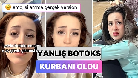 Yanlış Botoks İşlemi Yüzünden Aylarca Sadece Tek Kaşını Hareket Ettirebilen Kadın Oluşan Görüntüyü Paylaştı