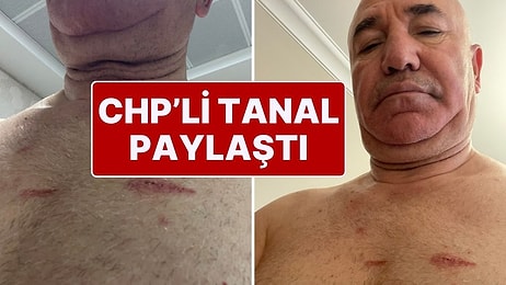 Mahmut Tanal Vücudundaki Darp İzlerini Paylaştı: “Suç İşliyorlar!”