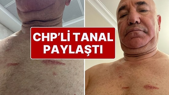 Mahmut Tanal Vücudundaki Darp İzlerini Paylaştı: “Suç İşliyorlar!”